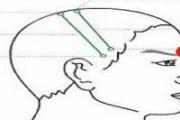 悬厘准确位置图 悬厘痛是什么病