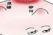 乳腺结节是怎么回事 乳腺结节三级怎么控制