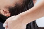 柏树果熬水洗头的功效 柏树果做枕头的作用与功效
