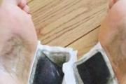 足贴变黑真的排毒减肥吗 足贴真的可以去湿气吗