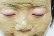 绿豆面膜可以天天敷吗