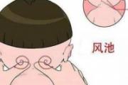 拿风池小儿推拿手法 小儿推拿风池的作用