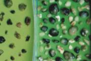 胆结石最佳治疗方法