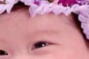 湿疹怎么引起的 湿疹什么症状