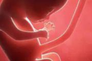 女生为什么不能养泰迪？养狗的危害