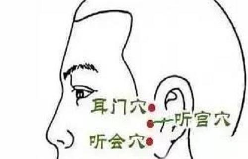 3听宫的作用听宫穴中有个"听"字,与五官中4听宫主治疾病1.