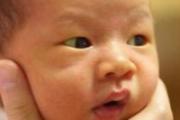 什么是母乳性黄疸