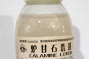 荨麻疹可以用炉甘石吗 炉甘石对荨麻疹有效吗