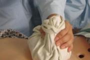拔罐后疼痛怎么缓解 四种方法帮助你缓解