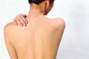 后背长痘痘怎么去除 6点你要注意