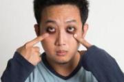 怎么消除黑眼圈 黑眼圈有几种