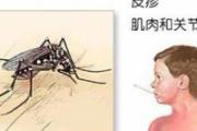 登革热有什么症状