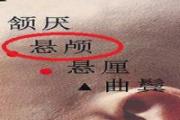 悬颅的准确位置图片 悬颅疼是为什么