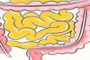肠癌的症状及表现 肠癌检查最准确的方法