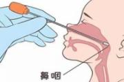 做鼻拭子不难受技巧 做鼻拭子出血影响检测结果吗