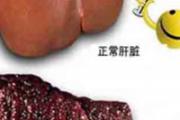 肝硬化的临床表现有哪些