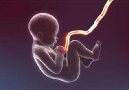 新生儿脐带半个月还没掉怎么回事脐带十几天还不掉怎么办 乐哈健康网 新生儿脐带半个月还没掉怎么回事脐带十几天还不掉怎么办 乐哈健康网