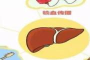 乙肝怎么预防传染 乙肝疫苗多长时间打一次