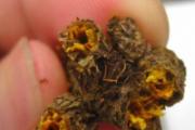 嘴巴里面溃疡小秘方 绝对值得你收藏
