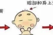 母乳黄疸怎么判断 母乳性黄疸的临床表现