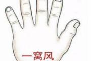 一窝风的准确位置图 小儿推拿一窝风的作用