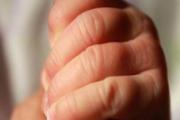 新生儿总胆红素正常值是多少 新生儿总胆红素异常值是多少