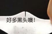 黑头贴怎么撕下来
