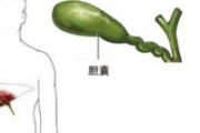 急性胆囊炎饮食注意