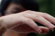 穴位敷贴治疗自汗