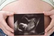 孕妇羊水少可以顺产吗