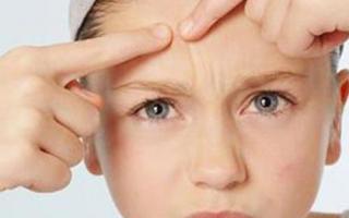 长闭口能用护肤品吗,长闭口护肤品可以用吗-乐