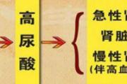 高尿酸是怎么形成的 怎么识别高嘌呤食物