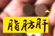 脂肪肝对人体的危害有多大 如何预防脂肪肝