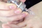 玻尿酸可以直接抹脸吗