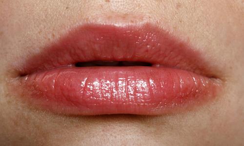 嘴唇上长泡不疼怎么办其实做到这几点就可以自愈哦 乐哈健康网