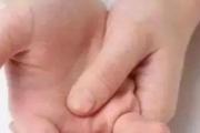 什么原因引起手脚麻木 手脚麻木怎么锻炼