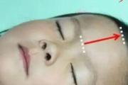 小儿推拿感冒鼻塞图解 谨记这些方法