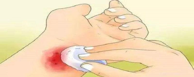 伤口发炎有哪些表现