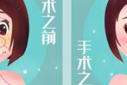 瘦脸针打一次不打了会怎么样 瘦脸针不打了会恢复吗