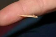 破伤风症状 什么是破伤风