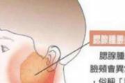 流行性腮腺炎潜伏期平均为