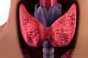 甲状腺结节会自愈吗