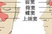 副鼻窦炎是什么