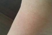 脚上起了好多小疙瘩特别痒