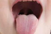 疱疹性咽峡炎是病毒感染还是细菌感染 它是如何感染的呢？