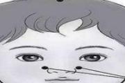 小儿迎香的准确位置图 小儿推拿揉迎香手法