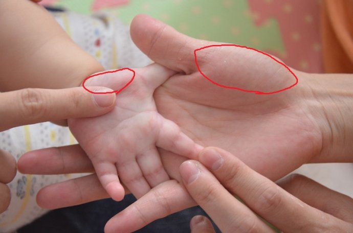 小儿厌食怎么办,婴儿厌食,宝宝厌食-乐哈健康网