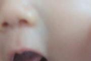 宝宝怎么预防鹅口疮 宝宝嘴巴里都是白白的白膜怎么办？其实这是鹅口疮，教你一招搞定