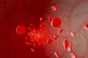怎么保护血管健康 5种食物养出健康血管