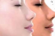 洗脸水里加什么可以改善皮肤变白 洗脸水里加这些